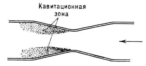 Вред кавитации